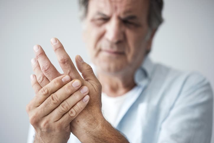 Rheumatoid arthritis 3 fokos kéz A kézízületek deformáló artrózisa