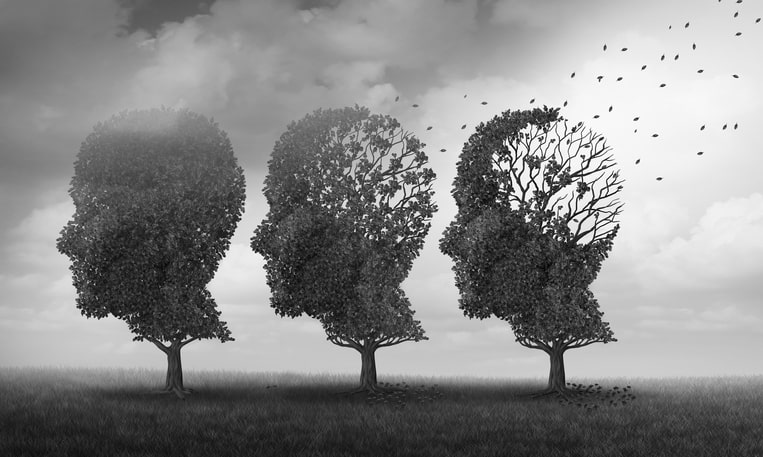 Understanding the Stages of Memory Loss - Santé Cares